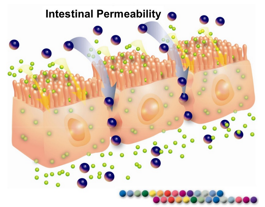 leaky gut syndrom intestinal-permeability